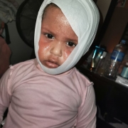 Battered Child Syndrome